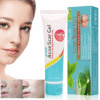Acne Scar Gel in Pakistan