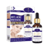 Aichun Beauty Anti Acne Whitening Facial Serum In Pakistan