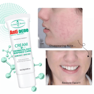 AICHUN BEAUTY Anti-Acne Cream Treats Pimple In Pakistan